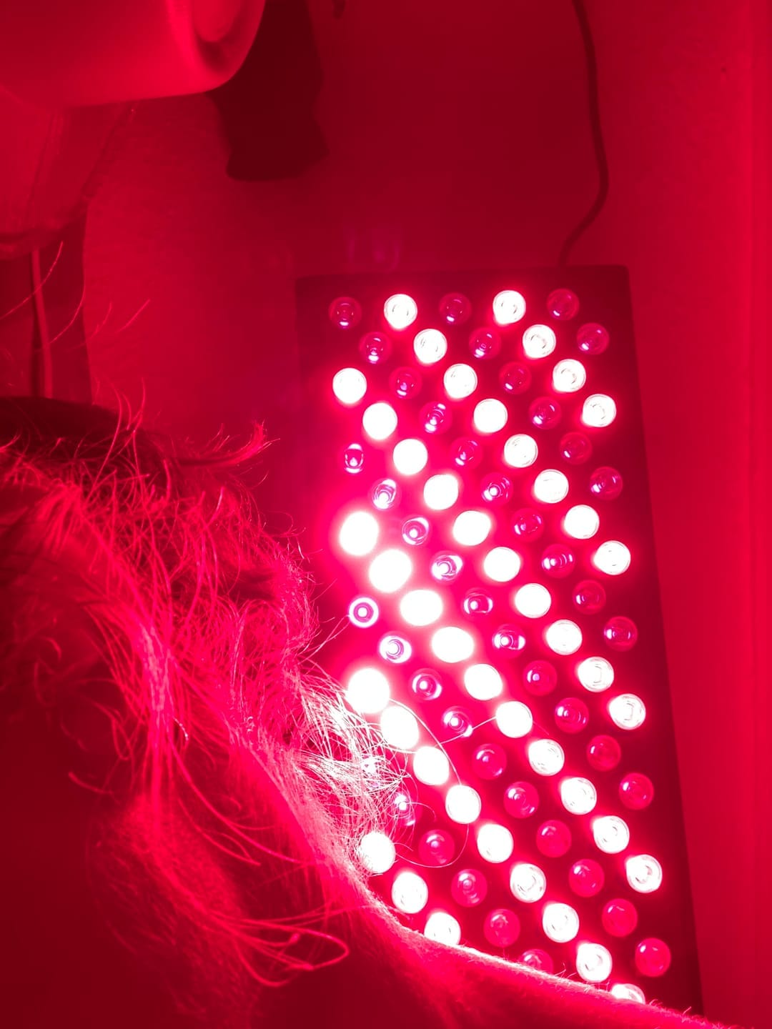 Customer photo review of Koanna® Luma1000™ – Powerful, Mid-Size Red Light Therapy Panel