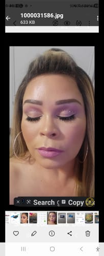 Customer photo review of WrinkleFix: Unlimited Toxins Membership Auto renew