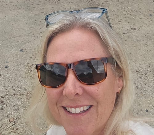 Customer photo review of Transform Wrinkles, Fine Lines, And Tired Creases Naturally