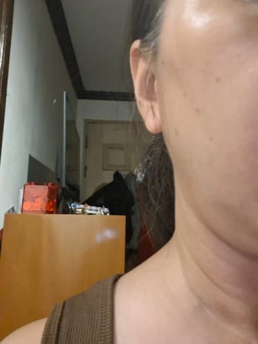 Close-up of a reviewer's hydrated skin after using the Bad Skin™ Korean Collagen Bomb Hydrating Ampoule.