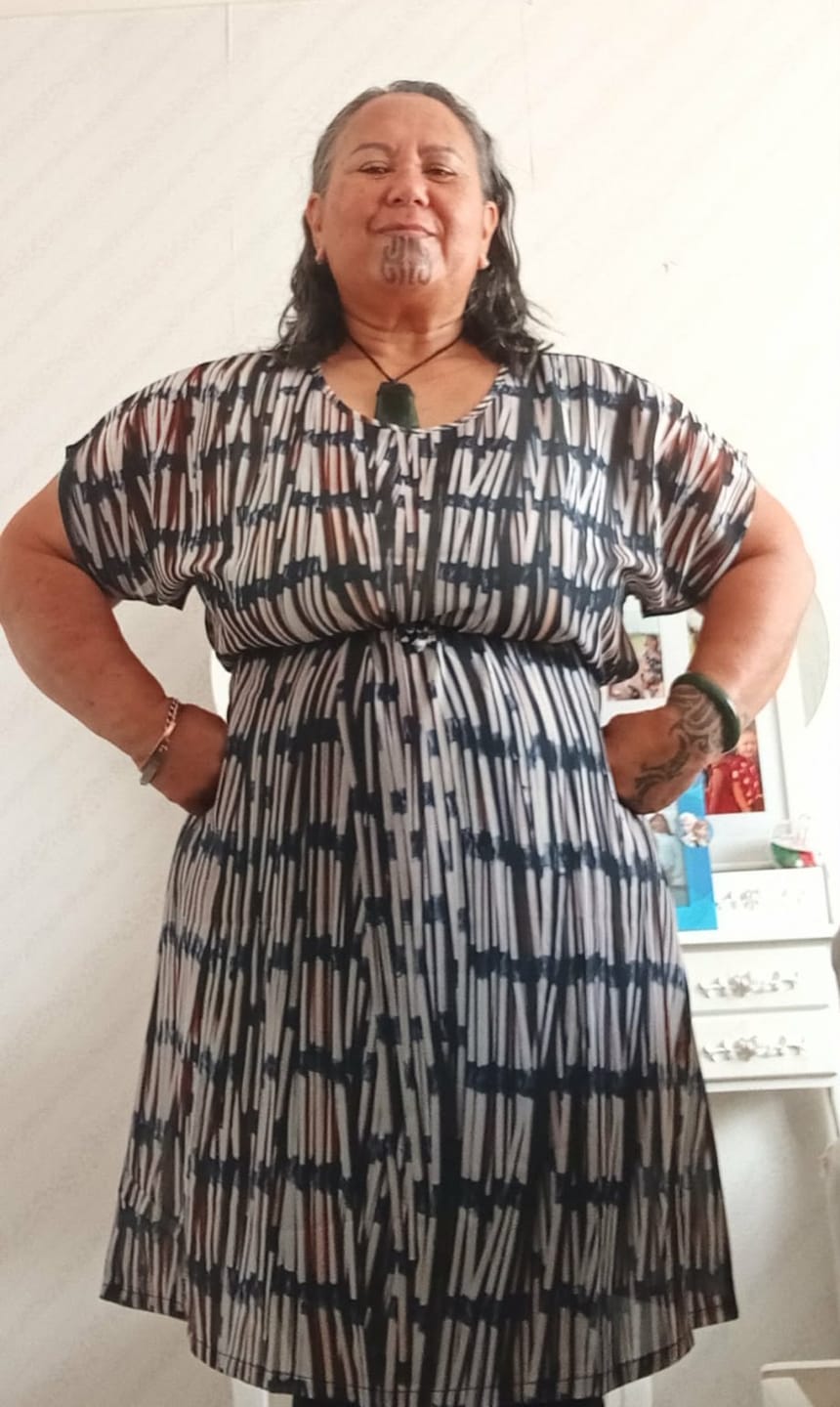 Customer photo review of Piupiu Print Dress - Mid Length
