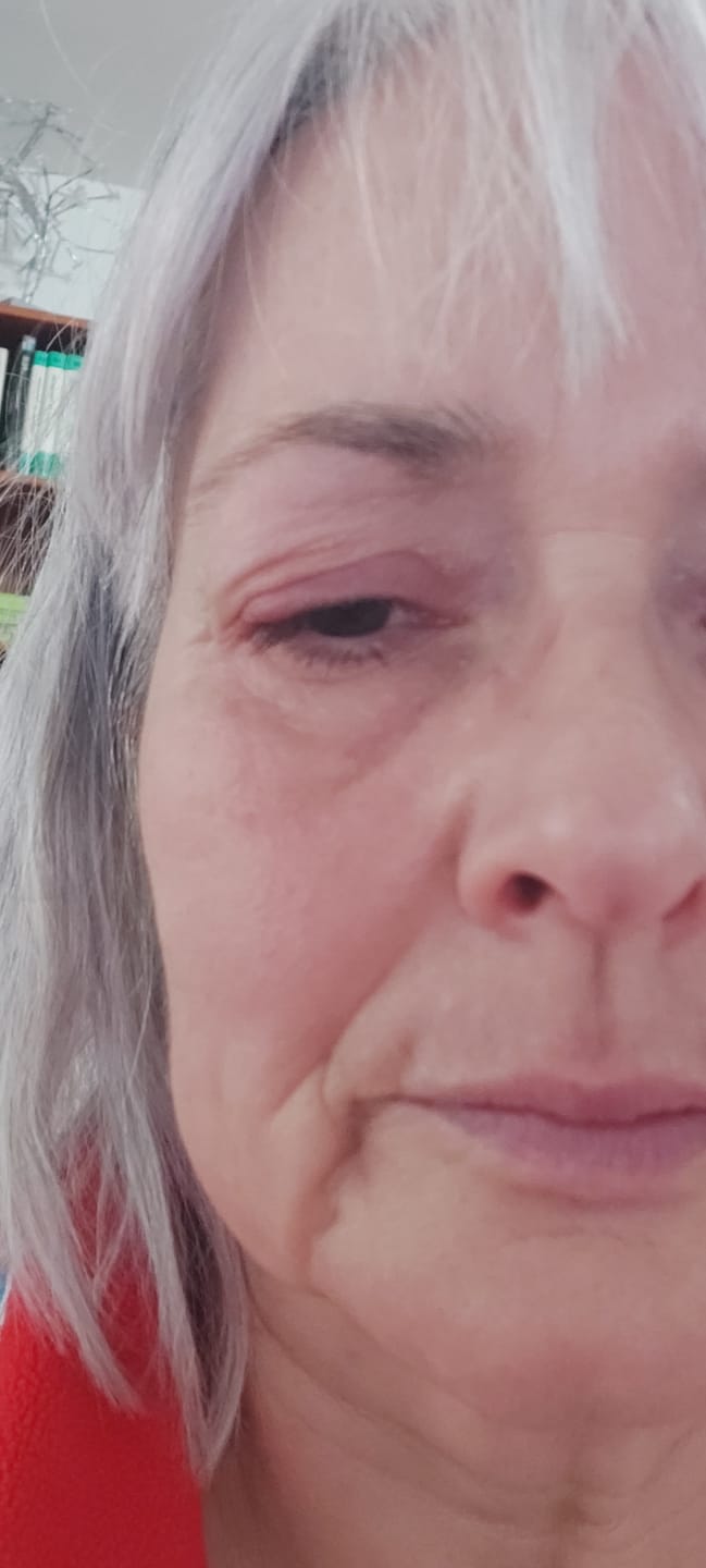 Customer photo review of LASHCOCA!NE PROLINE