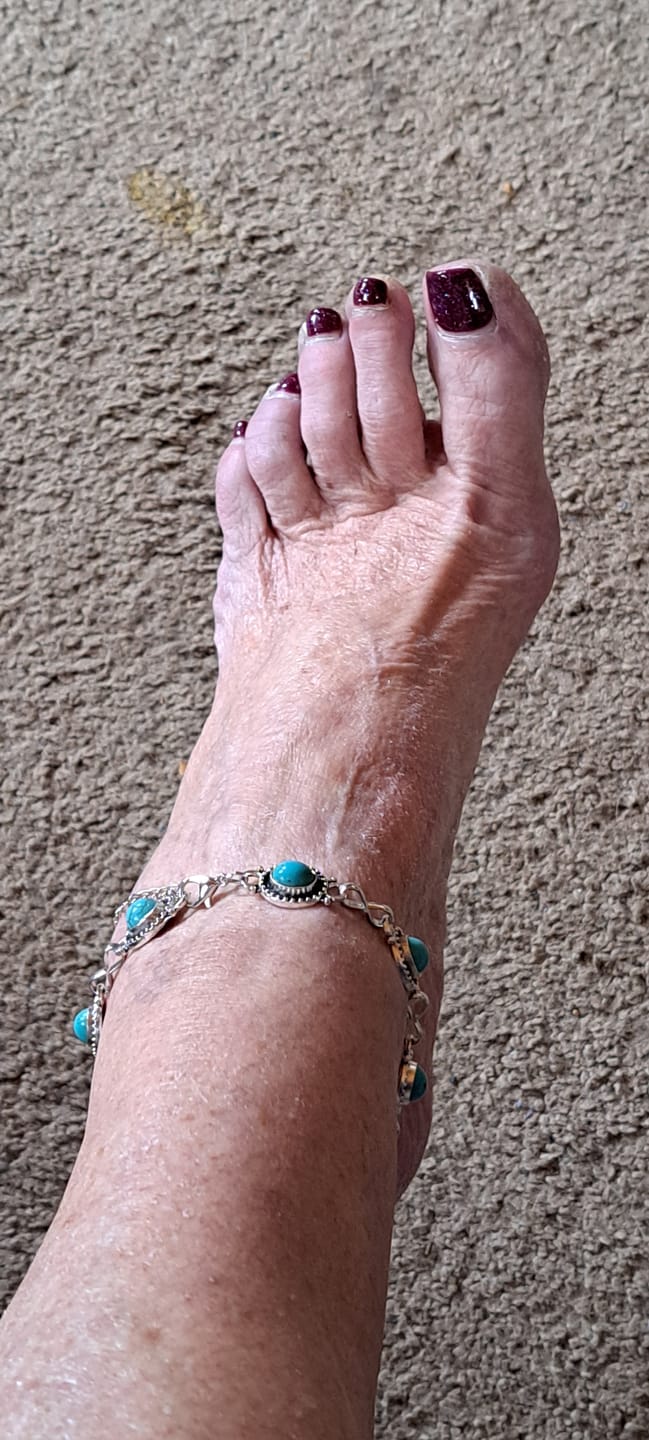Customer photo review of Bohemian Turquoise Anklet