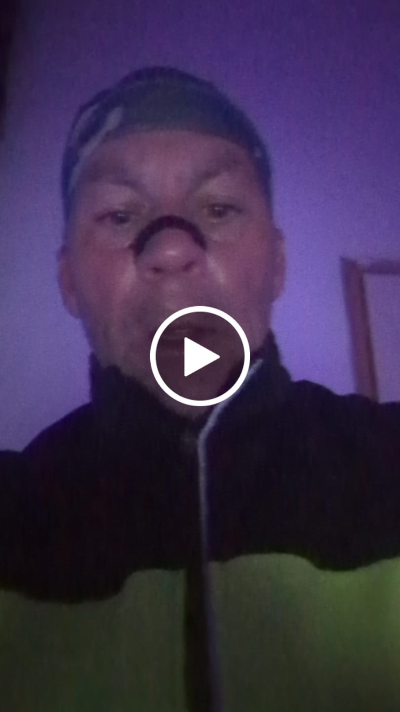 Customer video review of Black Nasal Strips
