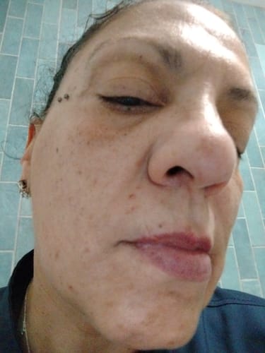 Customer photo review of Transform Wrinkles, Fine Lines, And Tired Creases Naturally