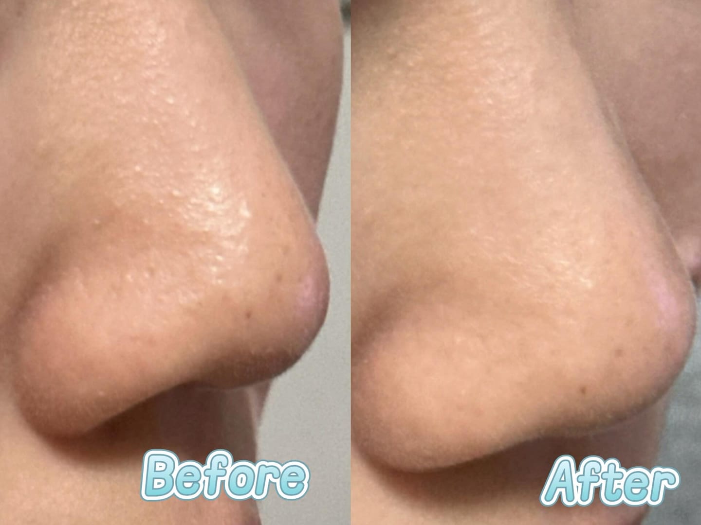Customer photo review of Clarifying Kaolin Clay Mask 50g