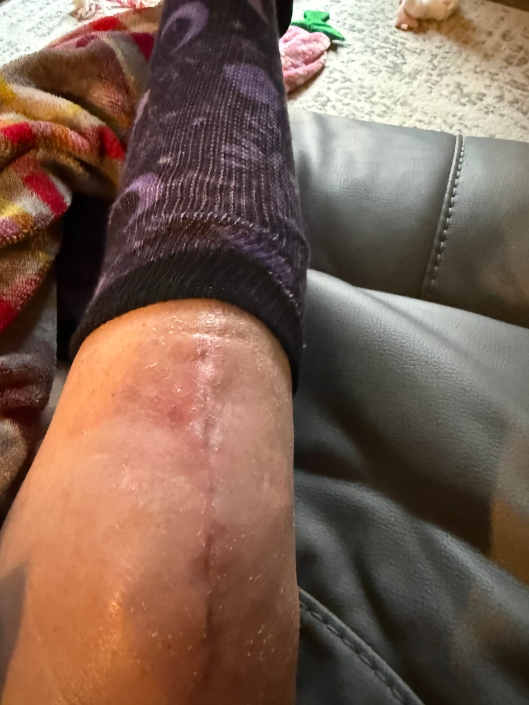 Customer photo review of Purple Moon EasyStretch™ Socks
