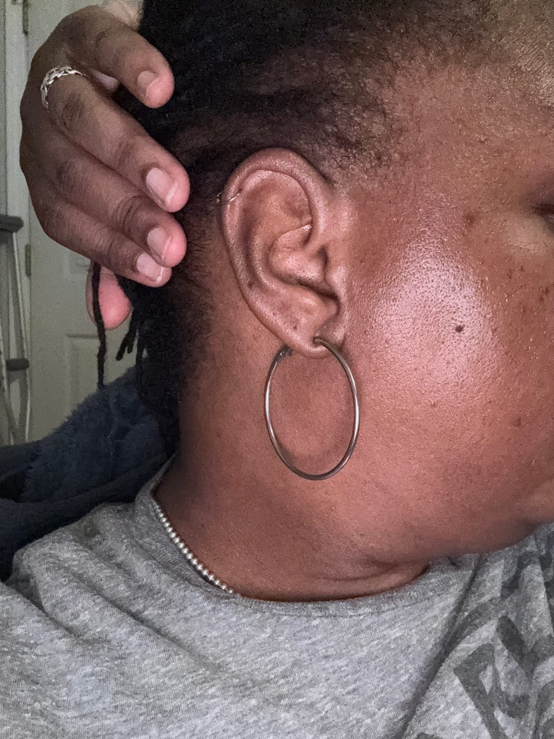 Customer photo review of LIMITED EDITION: Jolie’s Mini Full Body & Face Brightening Kit/ Acne Kit