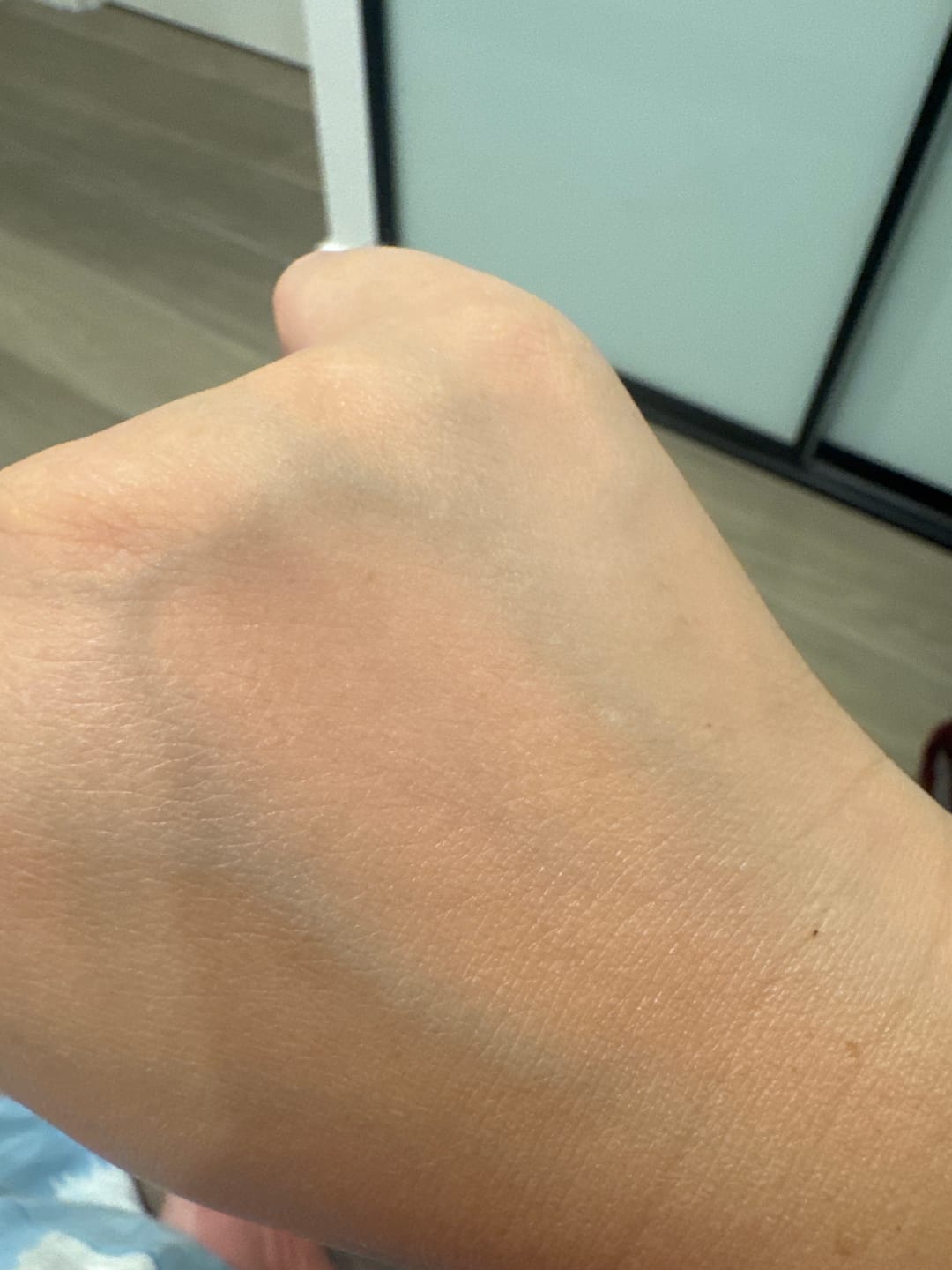 Customer photo review of Natural Sunscreen SPF 50