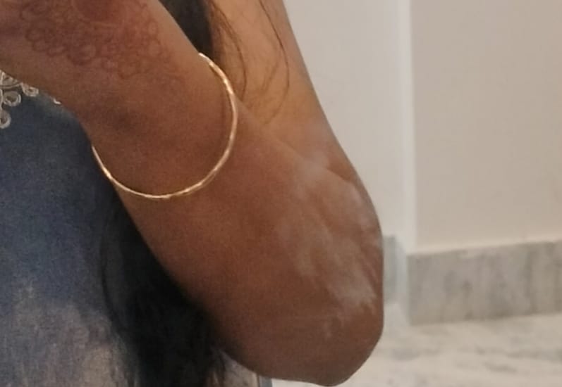 Customer photo review of Wave Bracelet