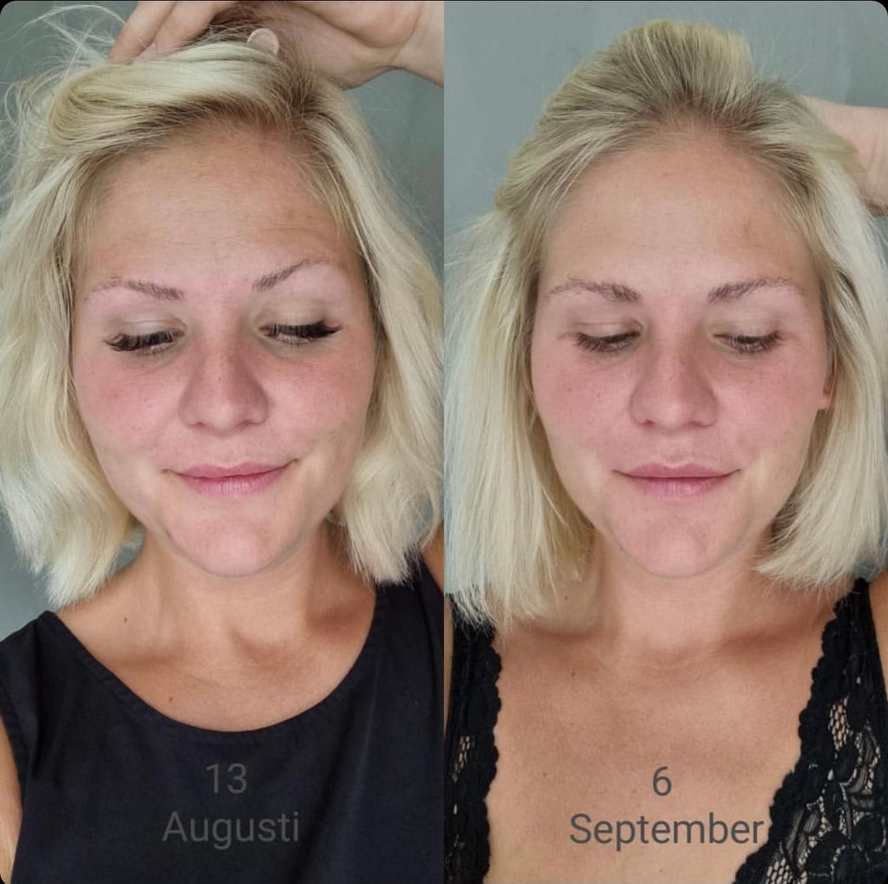 Customer photo review of Eyelash Growth Serum