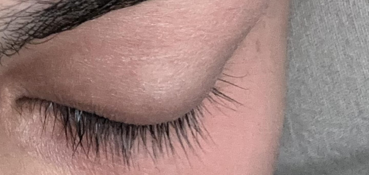 Customer photo review of Eyelash Growth Serum