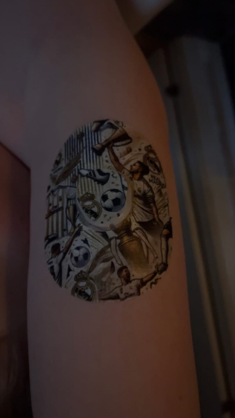 Customer photo review of Dexcom G7 Real Madrid Fotboll CGM-Sensor overpatches inkl. Sticker