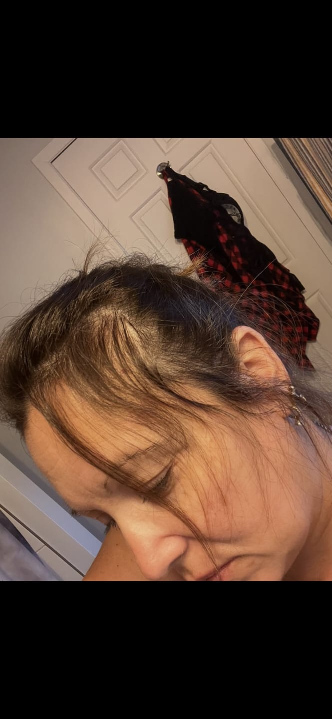Customer photo review of Celestine™ Gentle Scalp Massager