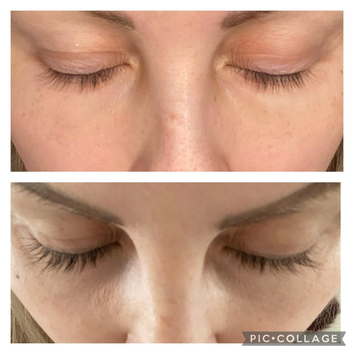 Customer photo review of Eyelash Growth Serum