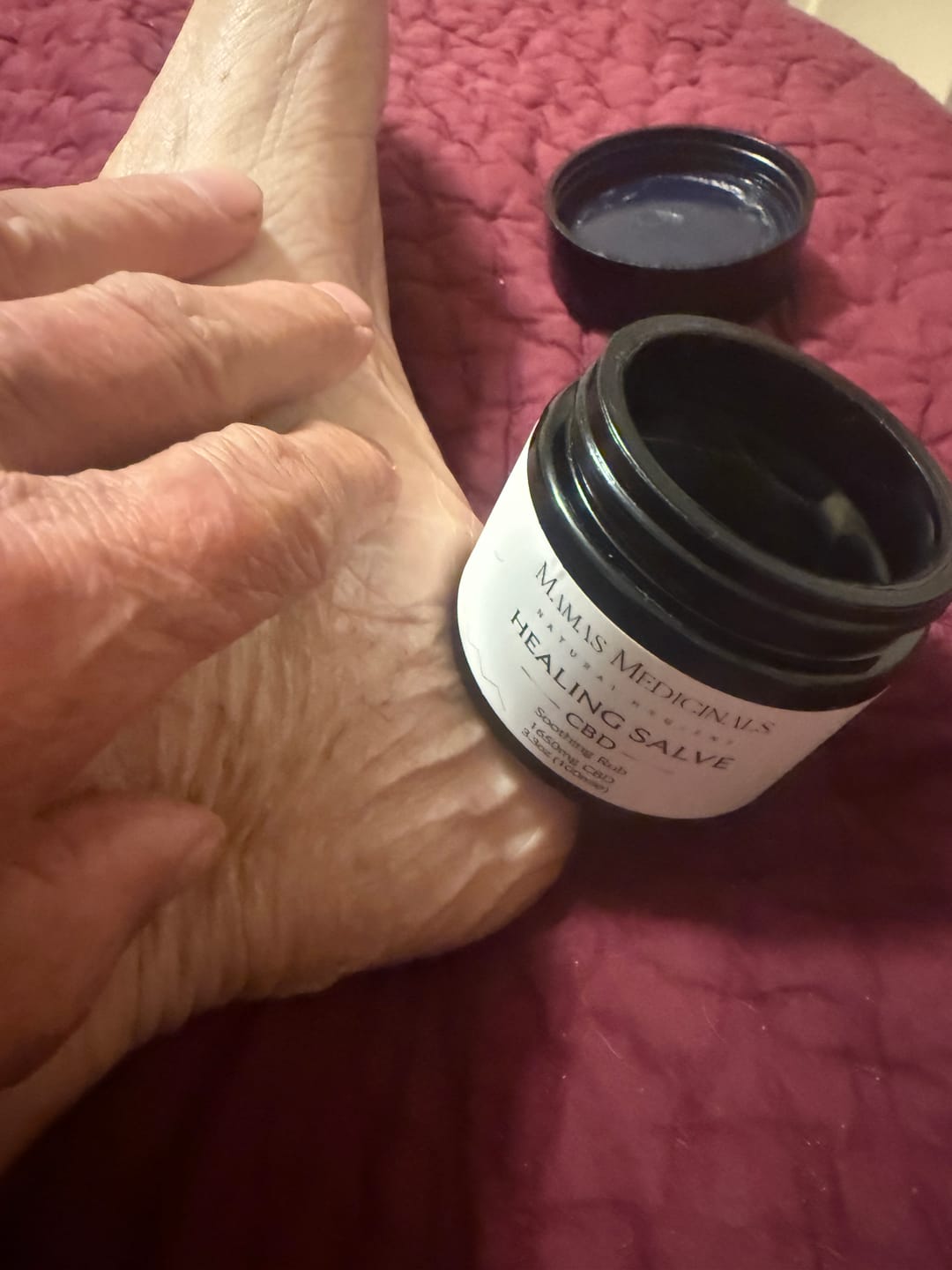 Customer photo review of Extra Strength Salve