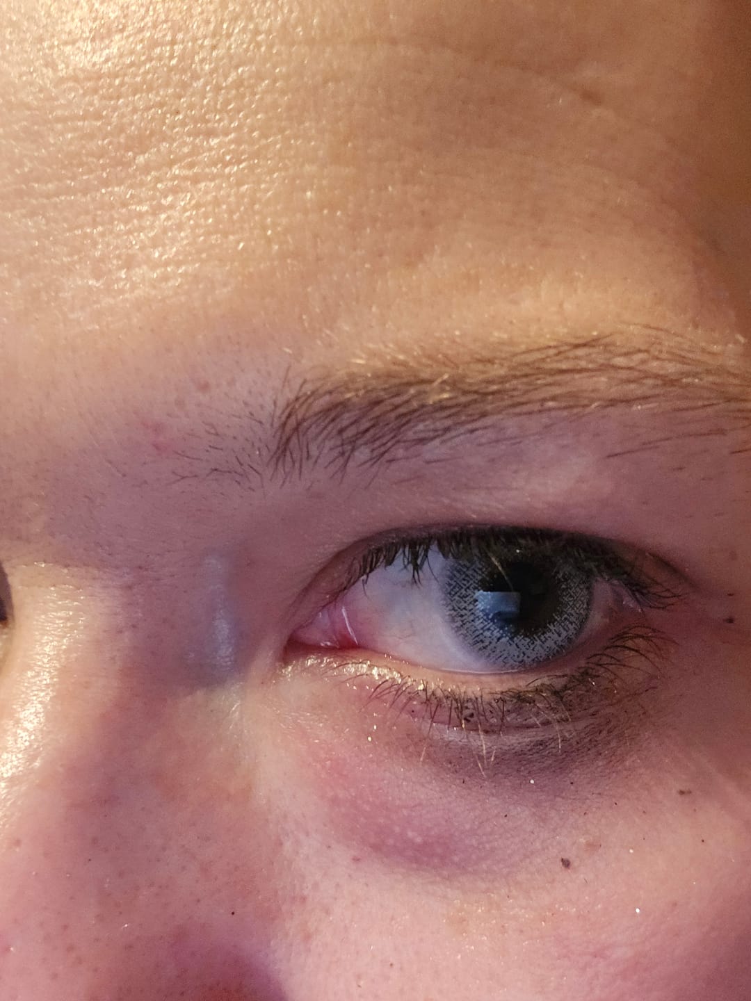 Customer photo review of FANTASY SNOW FLAKE Prescription Colored Contact Lenses