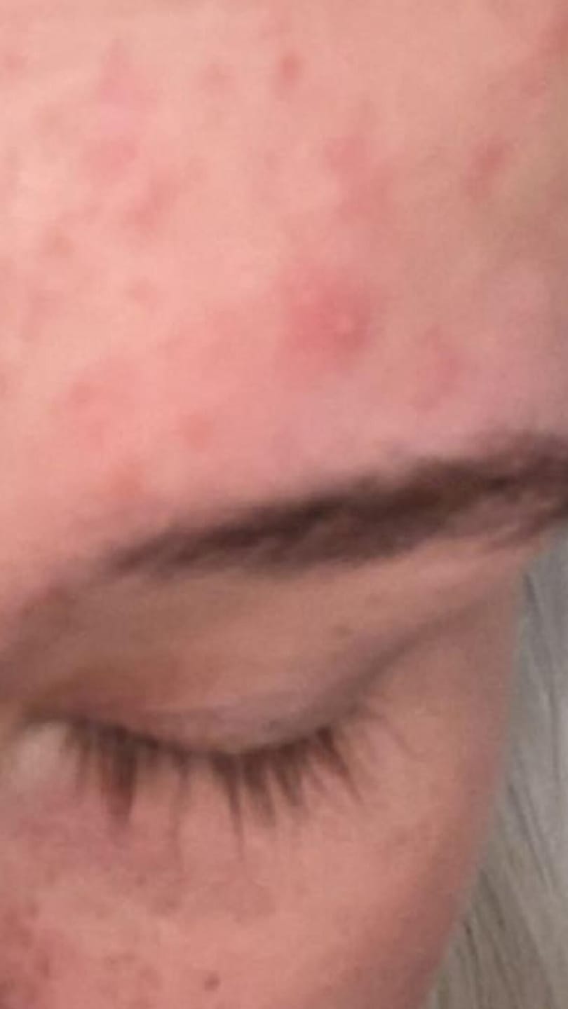 Customer photo review of Eyelash Growth Serum