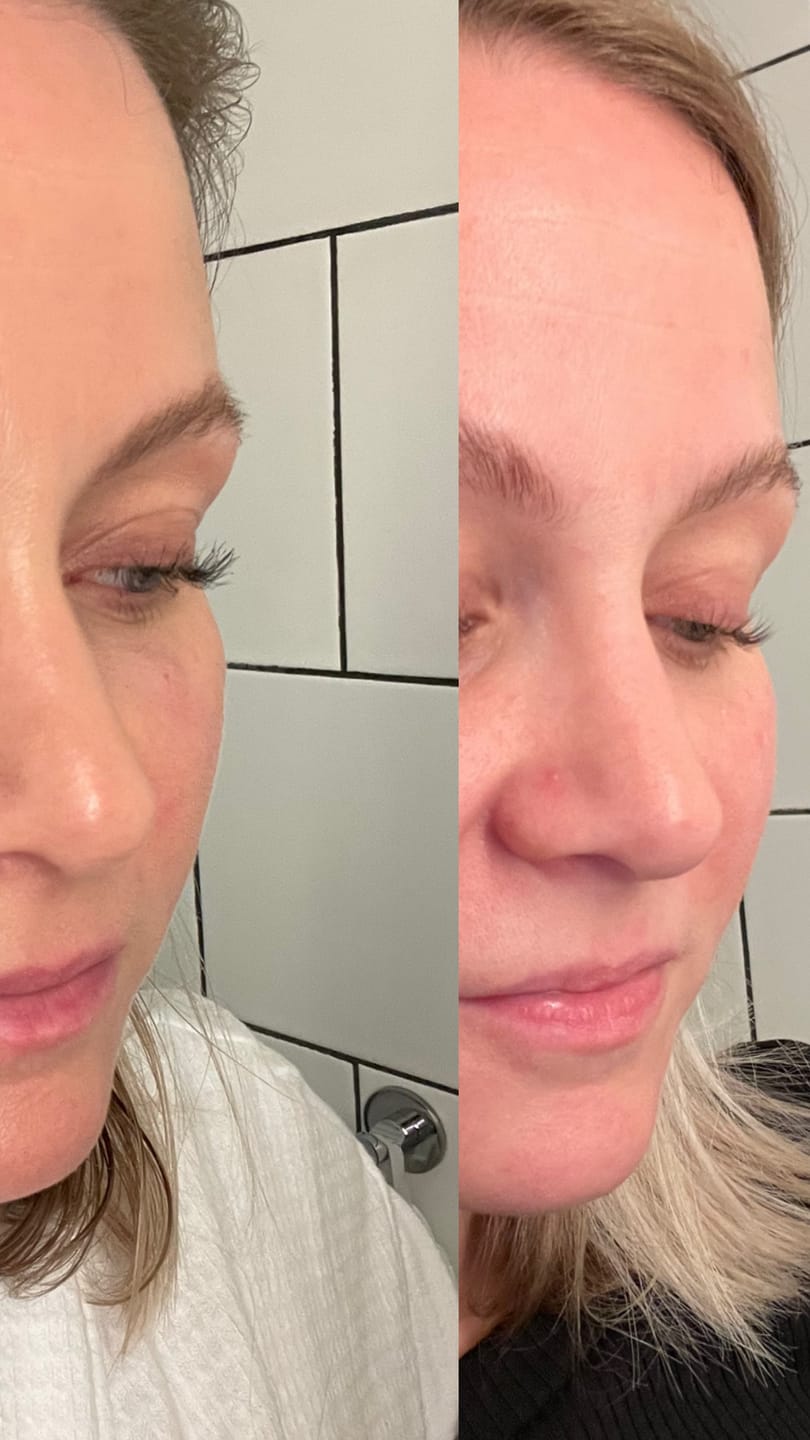 Customer photo review of Eyelash Growth Serum