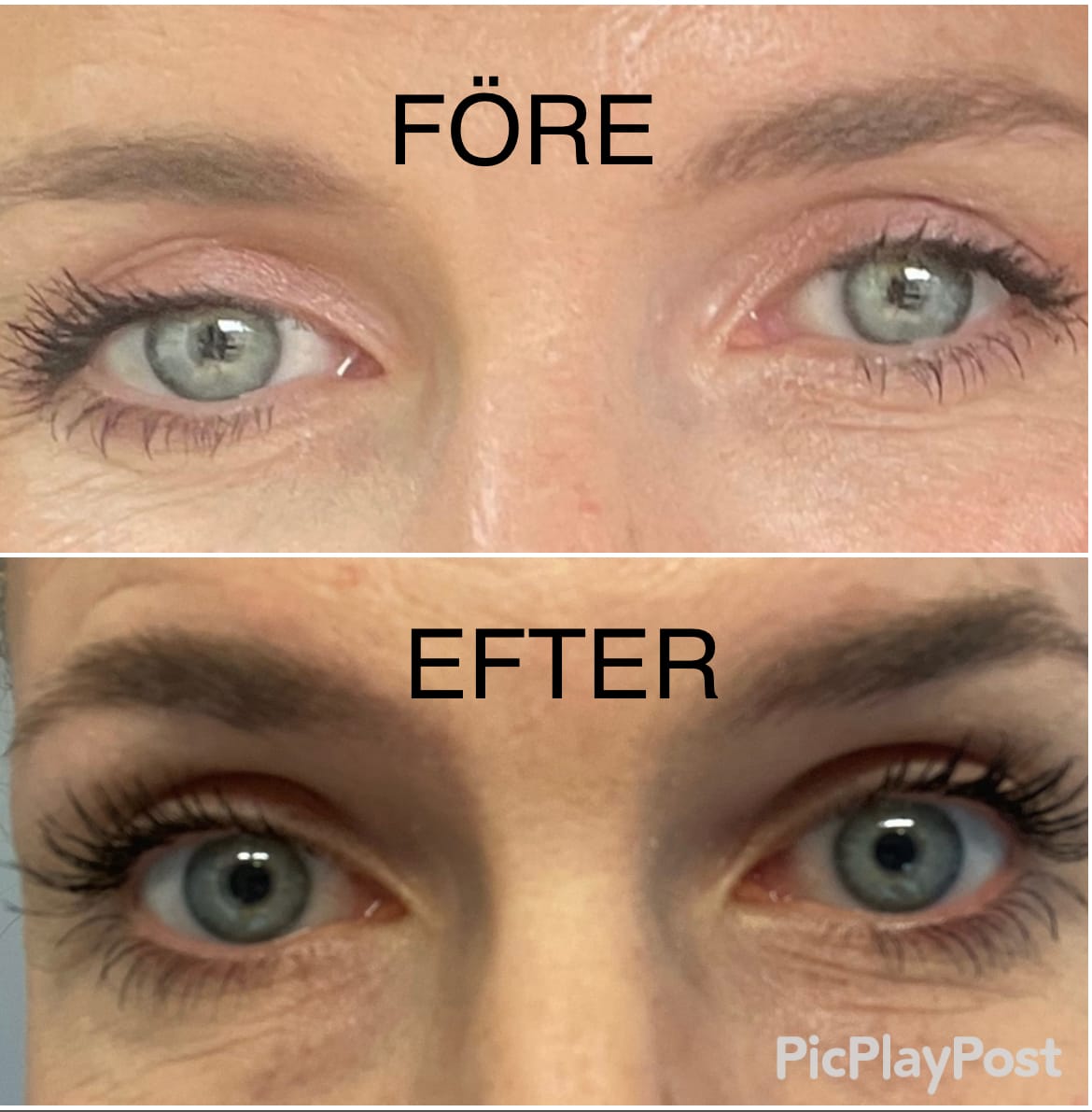 Customer photo review of Eyelash Growth Serum