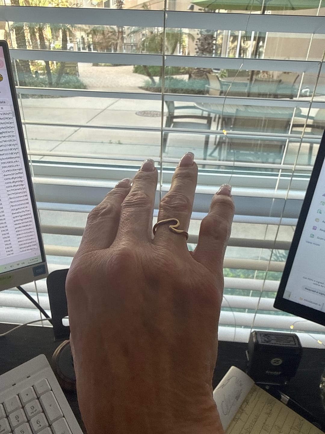 Customer photo review of Surfrider Ring