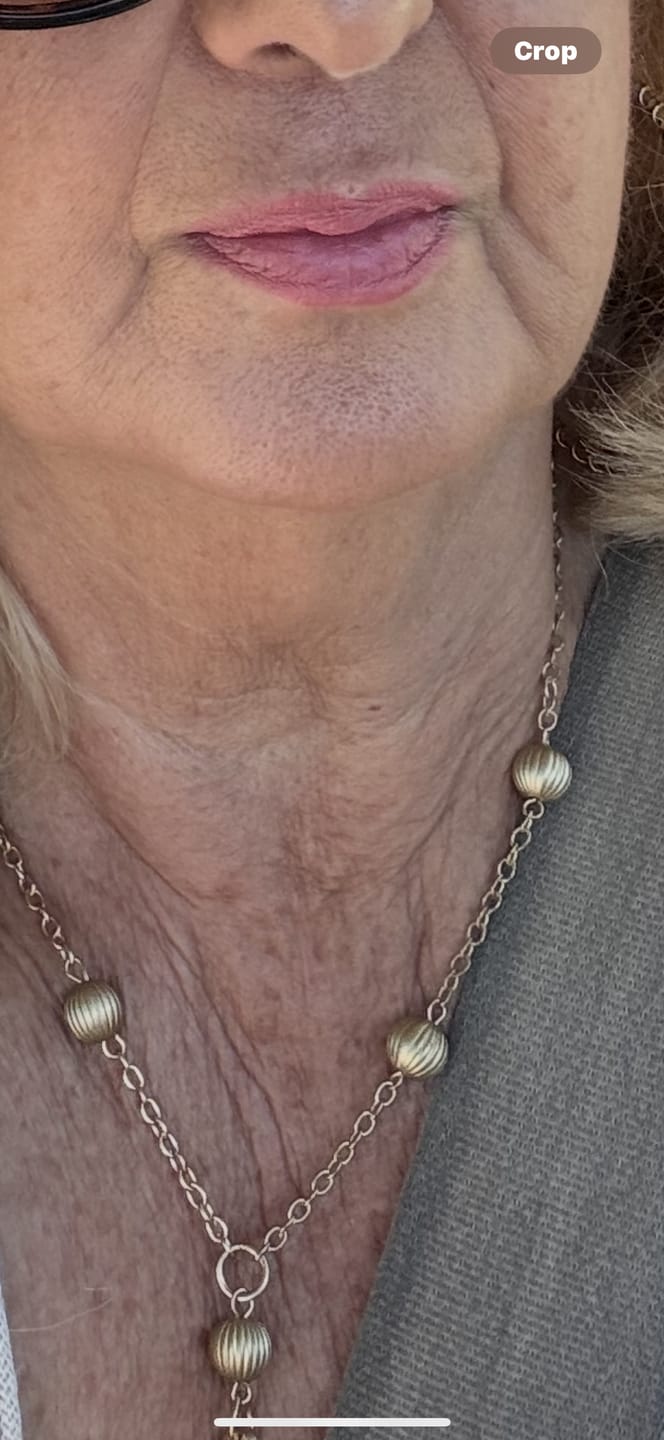 Customer photo review of Neck & Face Duo