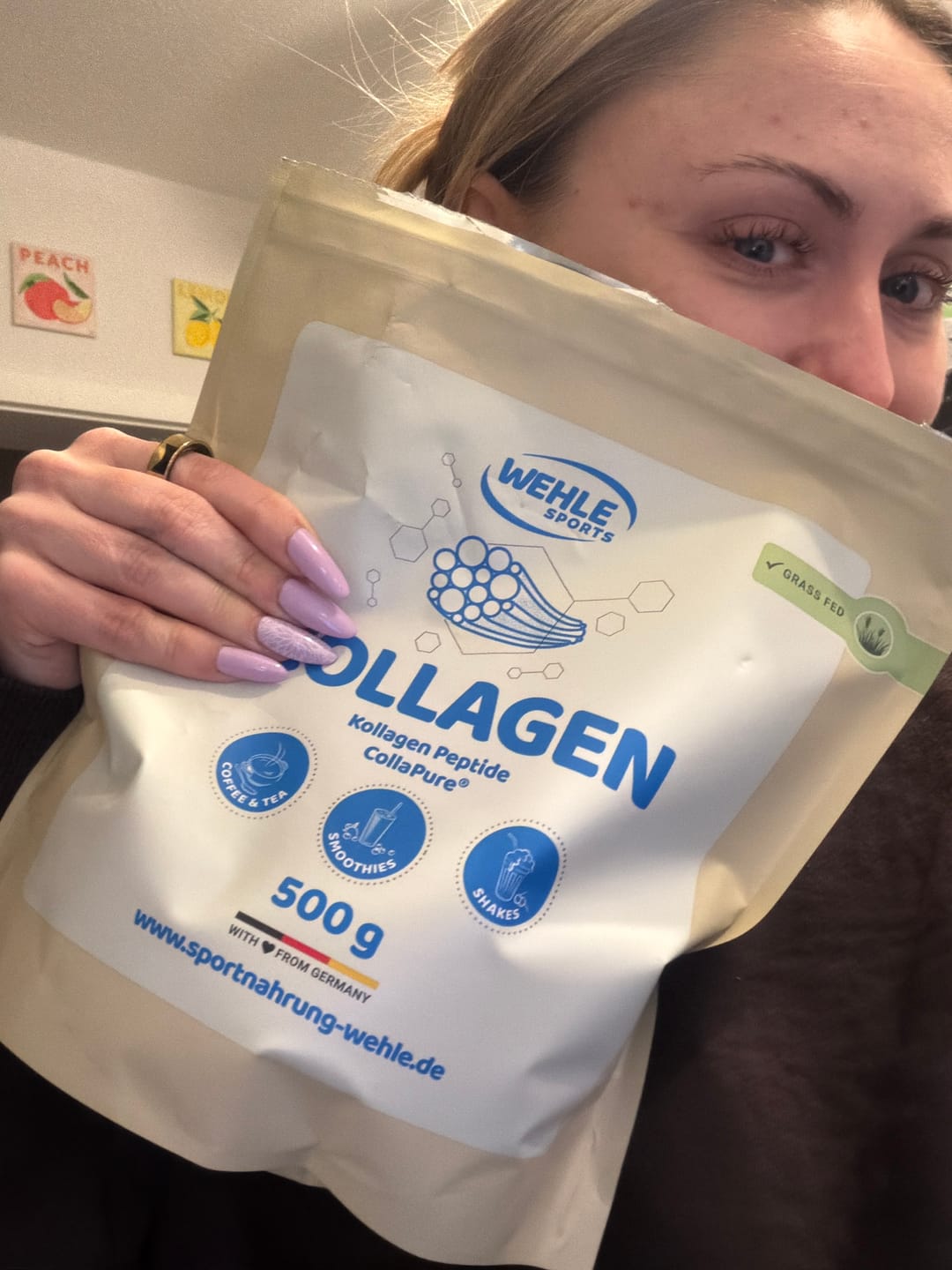 Customer photo review of Wehle Collagen Matrix 360°