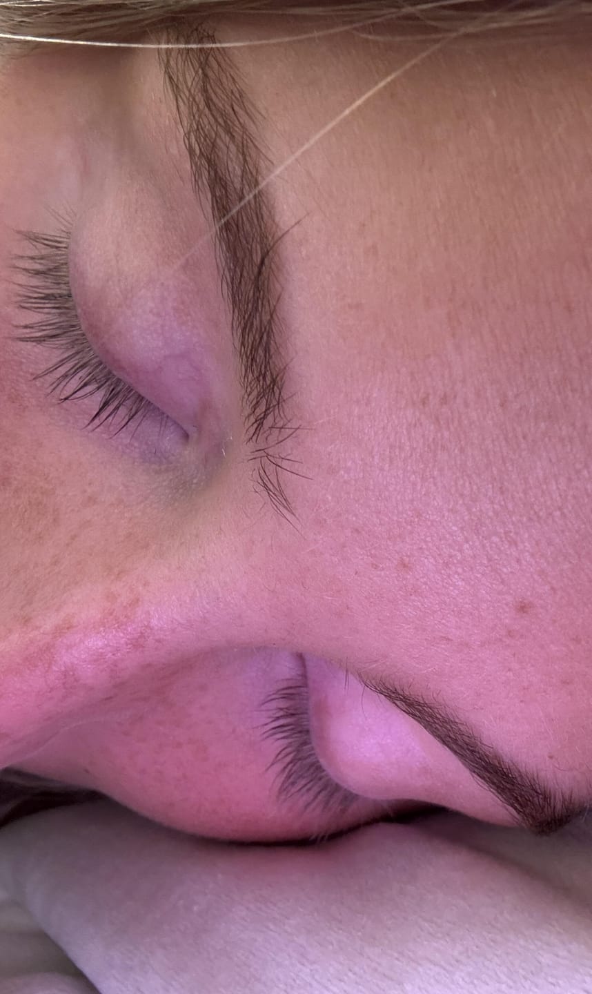 Customer photo review of Eyelash Growth Serum
