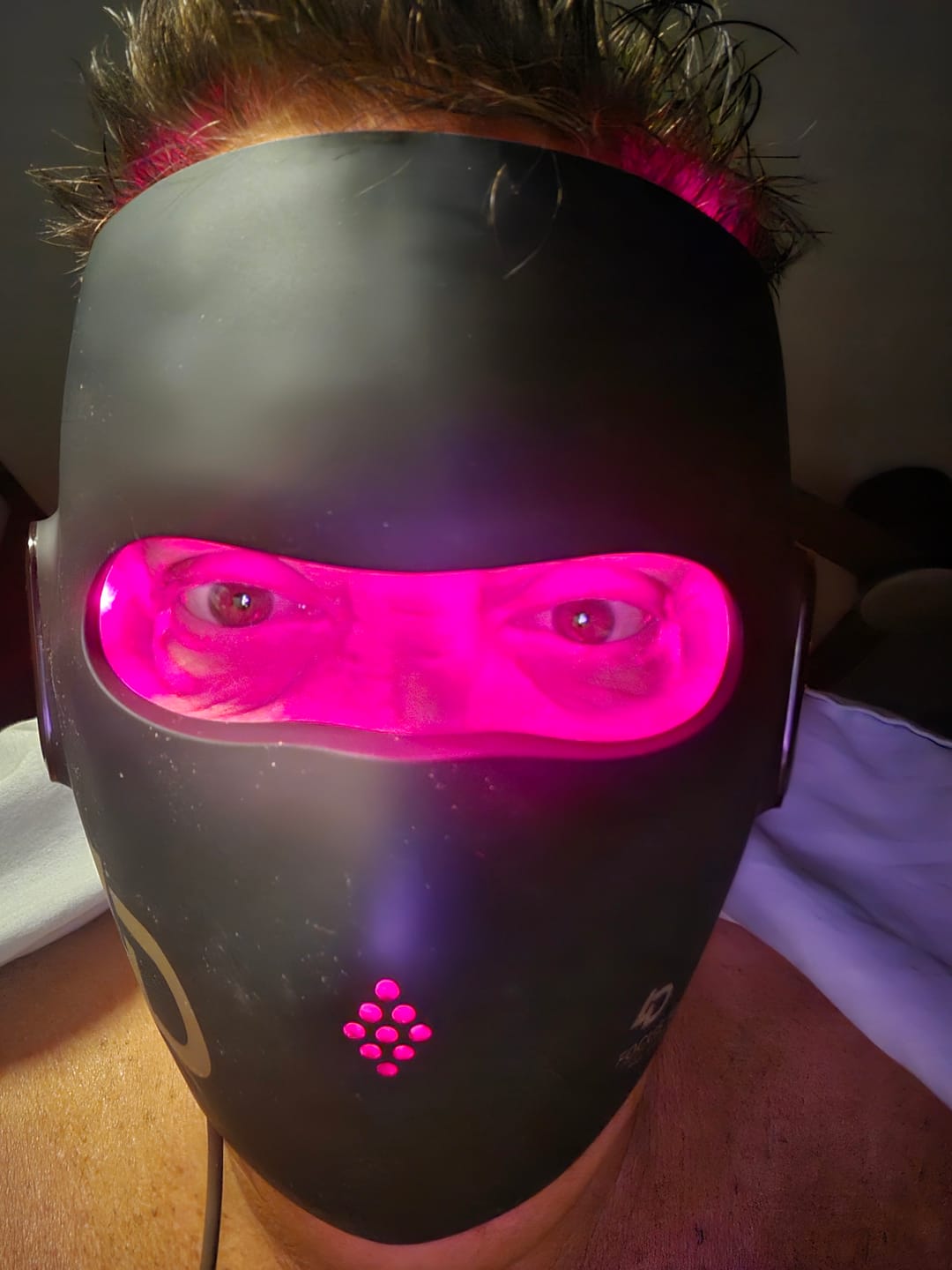 Customer photo review of JOVS 4D Laser Light Therapy Mask