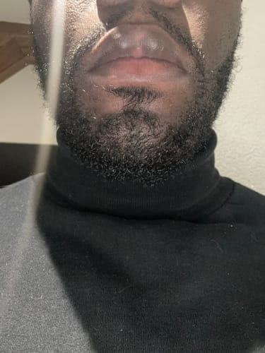 Gros plan sur la barbe d'un client après l'utilisation du Sérum Thorin.