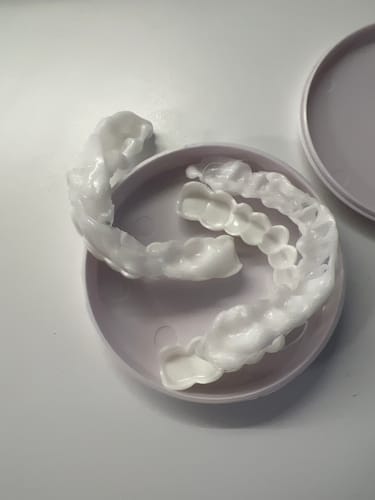 Customer photo review of Official SnapOn Veneers
