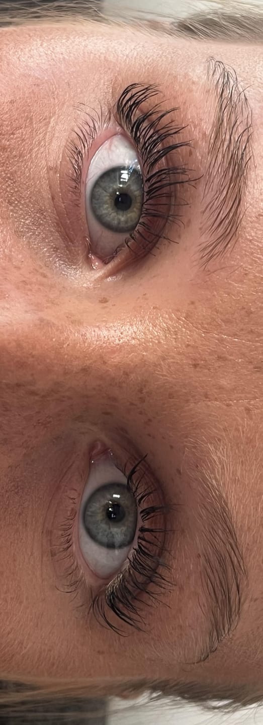 Customer photo review of Eyelash Growth Serum