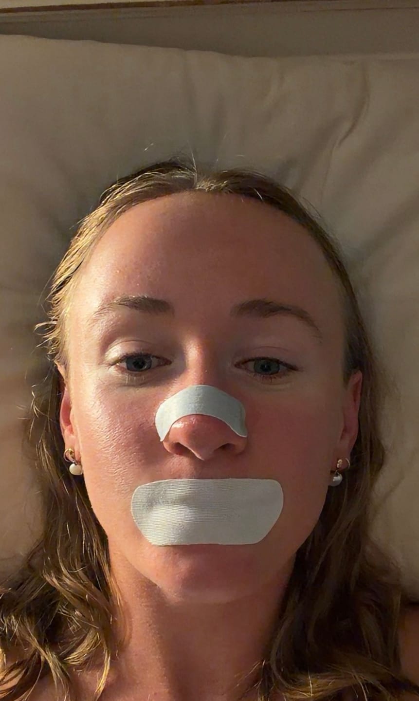 Customer photo review of FREE Nose Strips