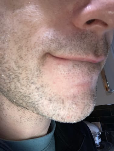 Customer photo review of Seb Natural Soothing Balm