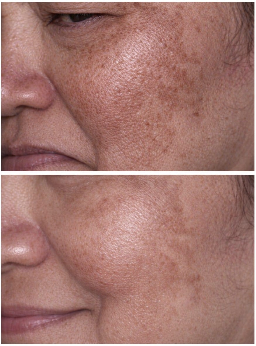 Customer photo review of Vitamin C 10% HYPERBOOST® Serum