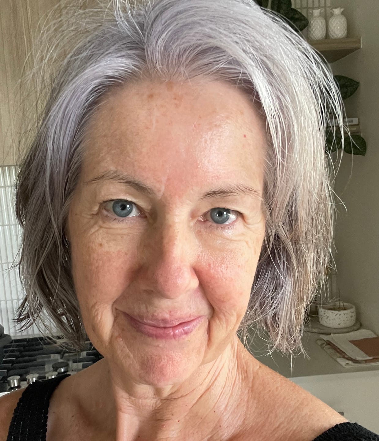 Customer photo review of SKIN TAG RESCUE DUO - Intensive targeted care for stubborn skin concerns