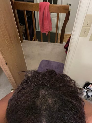 Reviewer's top-down view of their scalp showing thinning in their dark, curly hair, as context for their Rennora Hair Growth Serum review.