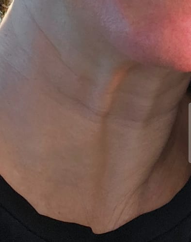 Customer photo review of Sérum de Exosomas Ultra Rejuvenecedor con Bioexosomas de Bakuchiol