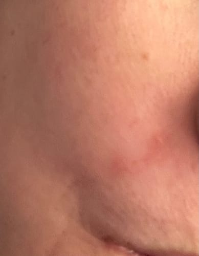 Customer photo review of Seb Natural Soothing Balm