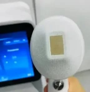 Customer photo review of Soprana Mini Diode Laser Hair Removal Machine