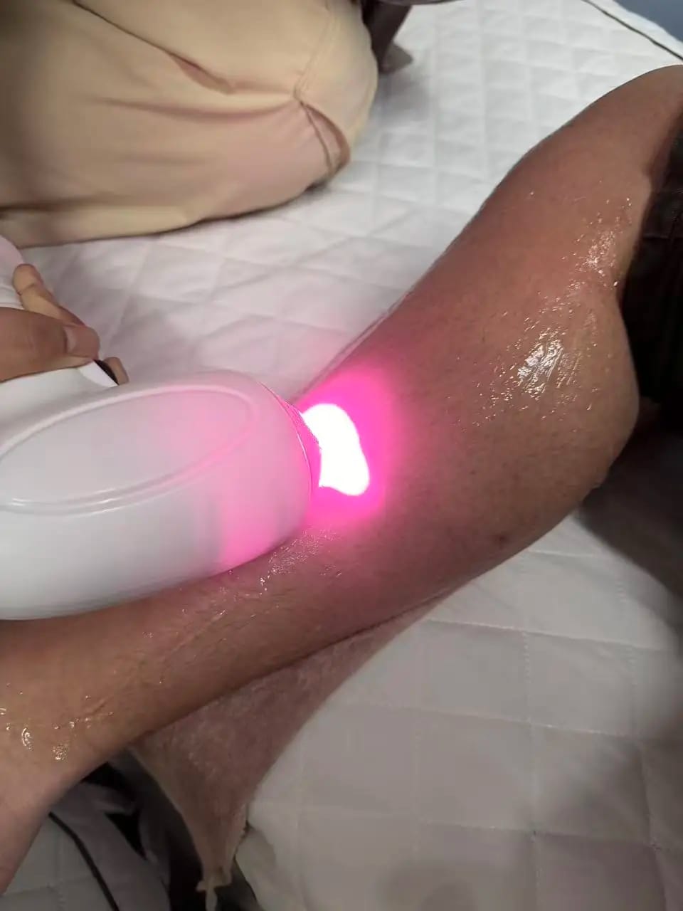 Customer photo review of Multi Laser Platform - Hair Removal Diode + Nd YAG