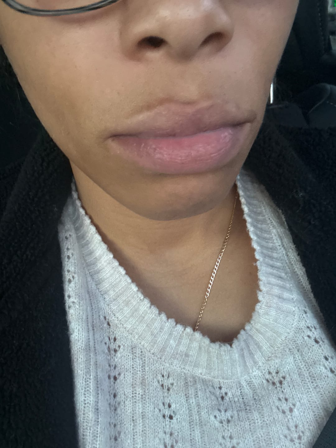 Customer photo review of Turmeric and Lemon Lip Balm (for Dark Lips)