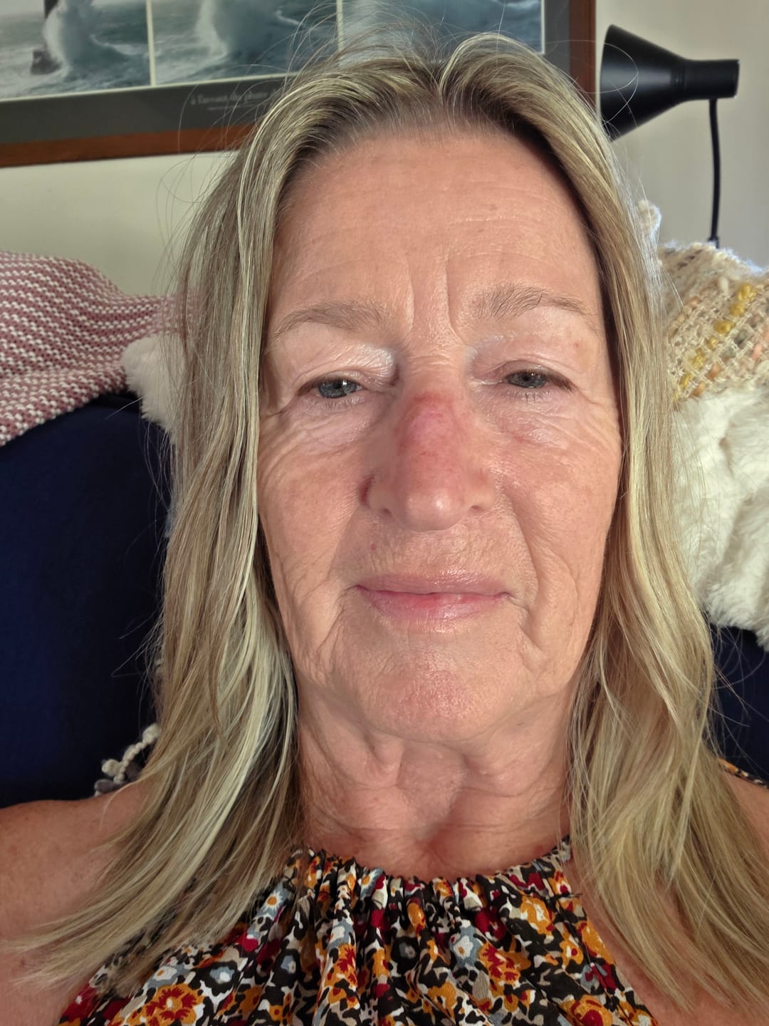 Customer photo review of EAORON Kakadu Plum Carnosine Cream - 50g