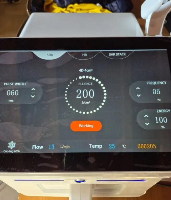 Customer photo review of Multi Laser Platform - Hair Removal Diode + Nd YAG
