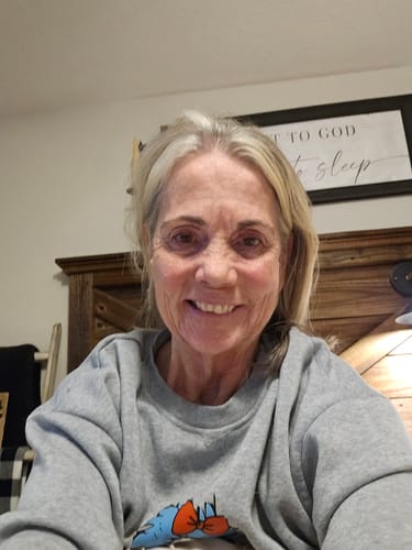 Customer selfie showing their facial skin in a review of the Seranova Micro Infusion System.
