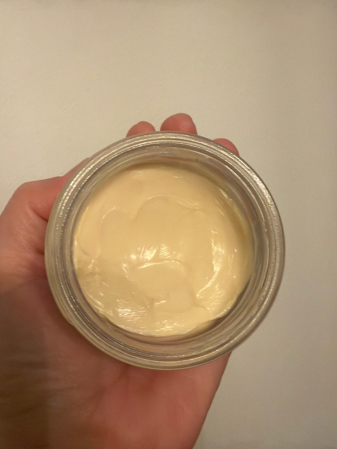 Customer photo review of Skin Therapy | Ultra-Rich Body Butter for Dry, Dehydrated Skin