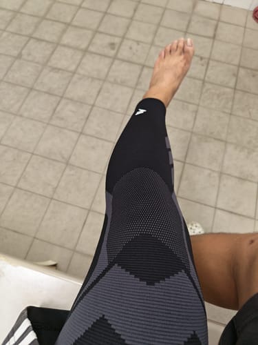 Customer photo review of Compression Sleeves V2 for Knees and Legs