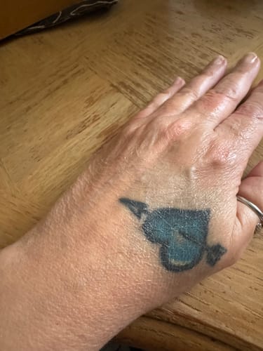 Reviewer's hand with a tattoo showing dry skin before using the Grass Fed Tallow & Honey Balm.