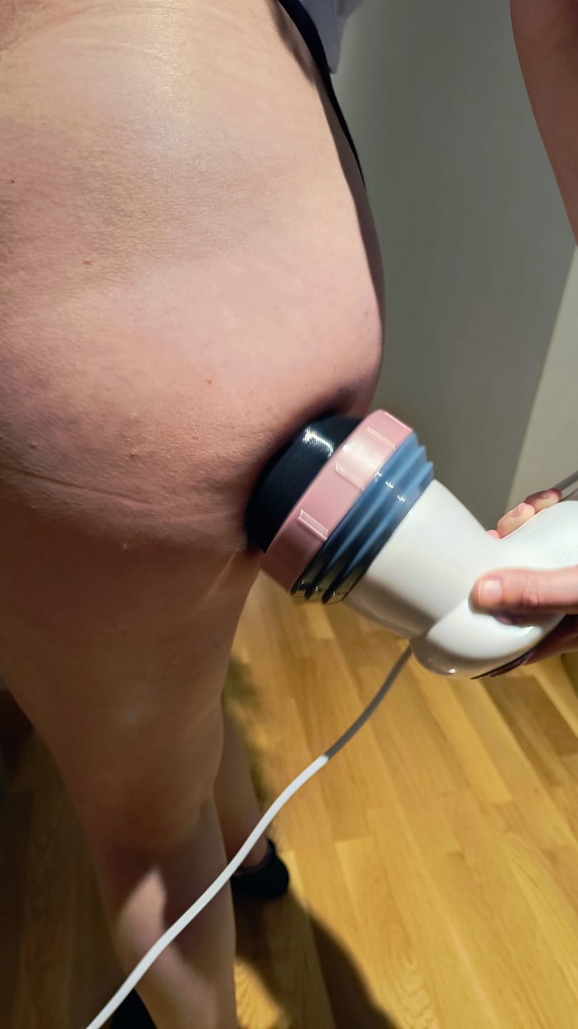 Customer photo review of Masajeador anticelulítico Cellu Clear Pro