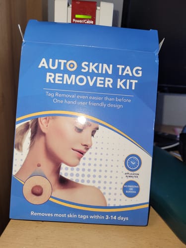 Customer photo review of Nie wieder Hautanhängsel